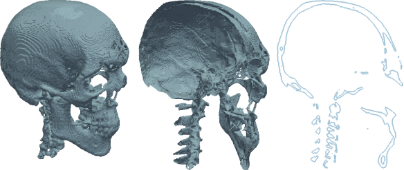 (From left to right) 3D surface model of a human skull, a clipped depiction, and a slice through its center.
